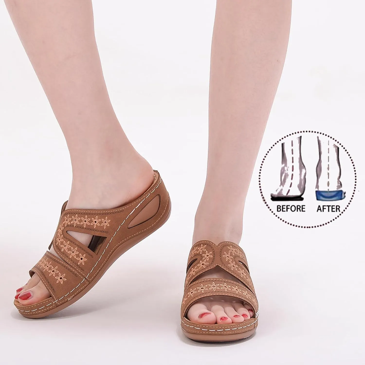 Women's Orthopedic Arch Support Wedge Sandals Summer Dressy 2025 Flat Open Toe Casual Flip Flops Platform Sandal Beach Sandals Dress Shoes Slip on Open Toe Sandal 2025